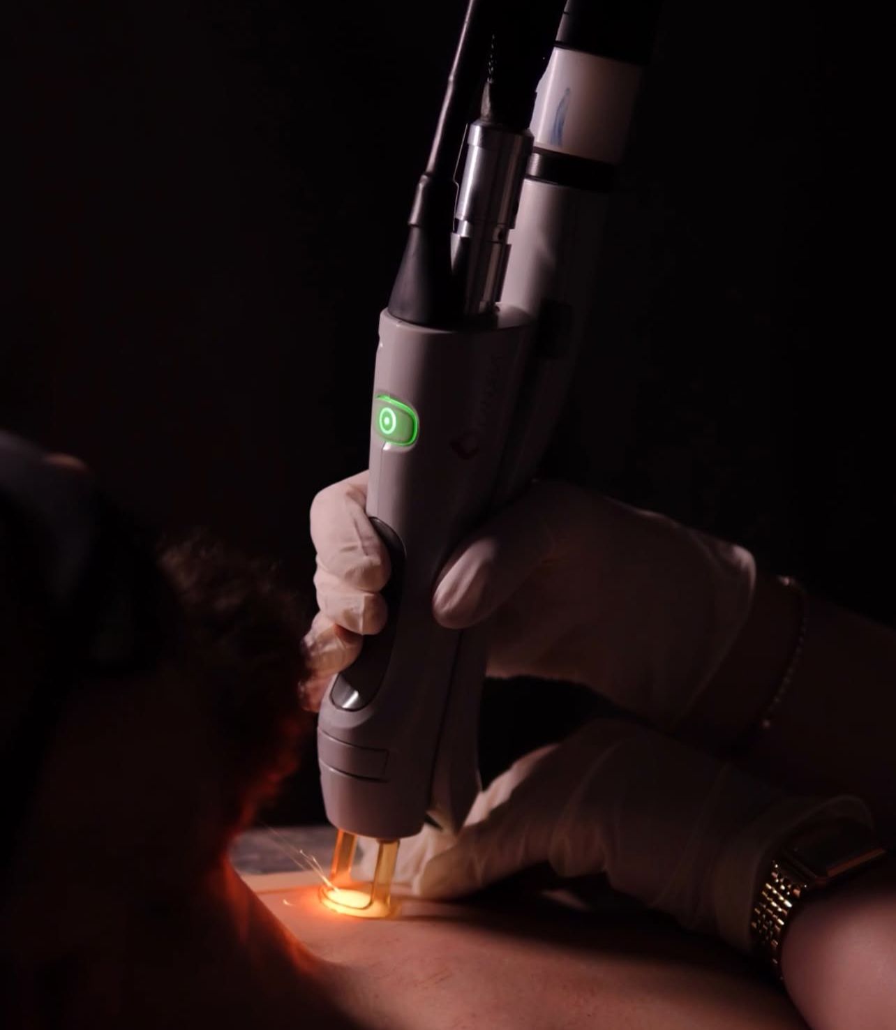 Alexandrite Candela GentleMax Pro