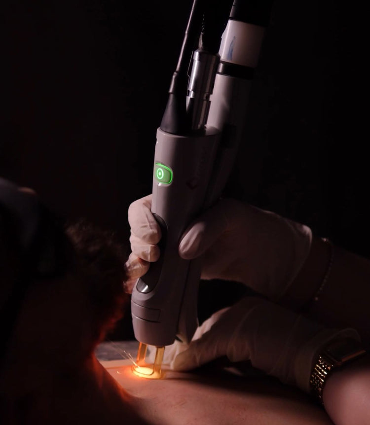 Alexandrite Candela GentleMax Pro