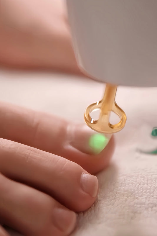 Cleaning Nail Fungus Nd:YAG